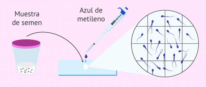 Imagen: Tinción del semen para evaluar la morfología espermática