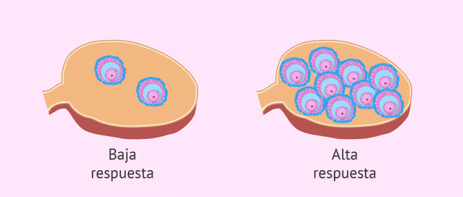 Imagen: Tipos de respuesta a la estimulación ovárica