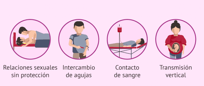 Imagen: Vías de transmisión del VIH