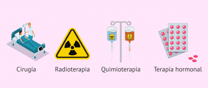 Imagen: Tipos de tratamiento para el cáncer de mama