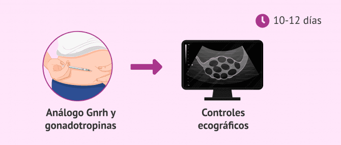 Imagen: Estimulación ovárica en el método ROPA
