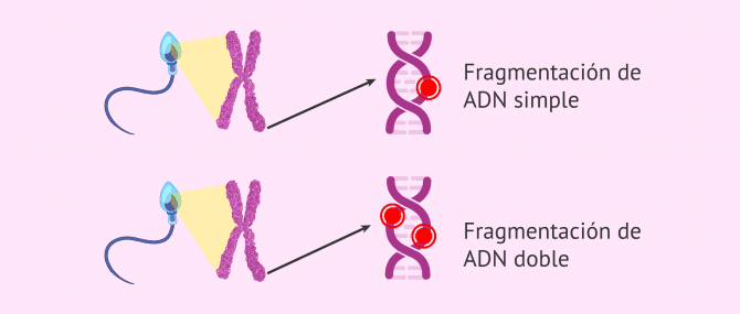 Imagen: Fragmentación del ADN espermático