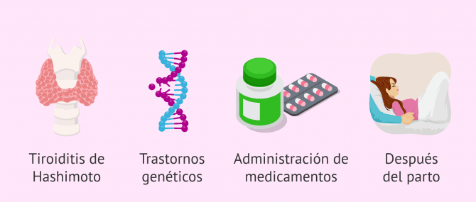 Imagen: Factores que aumentan el riesgo de hipotiroidismo