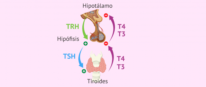 Imagen: Esquema del hipotiroidismo