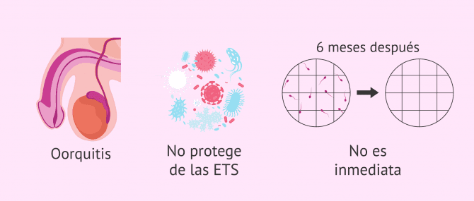 Imagen: ¿Qué inconvenientes tiene la vasectomía?