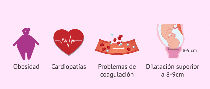 Imagen: ¿Cuándo no se aconseja la epidural?