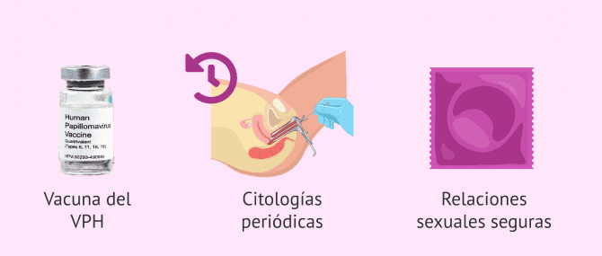 Imagen: Vacunación del VPH