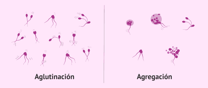 Imagen: Agregación o aglutinación