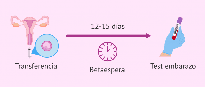 Imagen: Periodo de betaespera