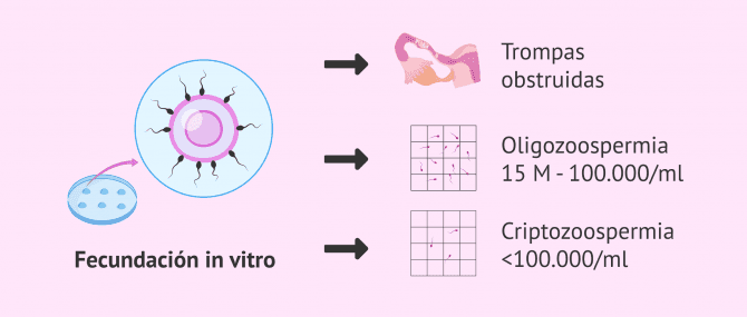 Imagen: FIV para problemas de fertilidad en el hombre y la mujer