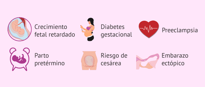 Imagen: Riesgo de aborto espontáneo