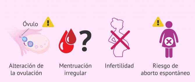 Imagen: Consecuencias en la fertilidad femenina por problemas tiroideos