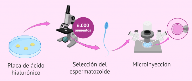 Imagen: PICSI o ICSI Fisiológica