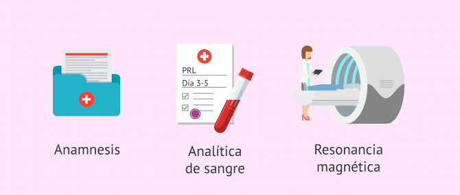 Imagen: Pruebas diagnósticas para la hiperprolactinemia