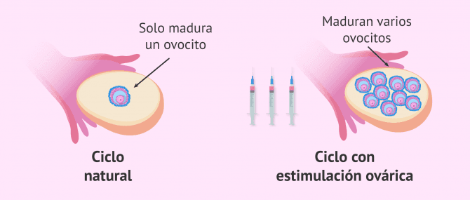 Imagen: Maduración de ovocitos natural vs. estimulada