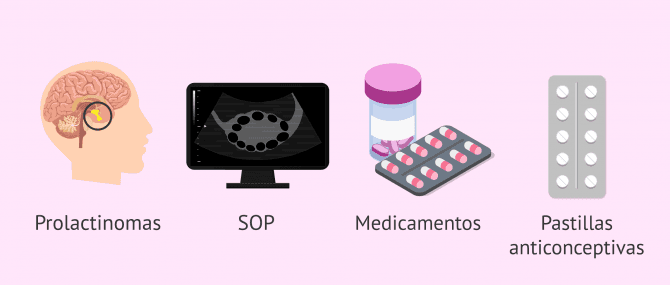 Imagen: Otras causas de hiperprolactinemia