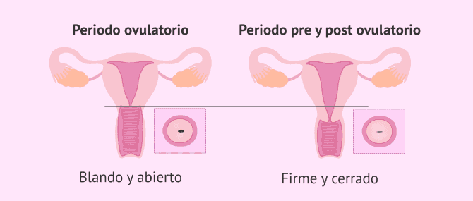 Imagen: Cambios en el cérvix durante el ciclo menstrual