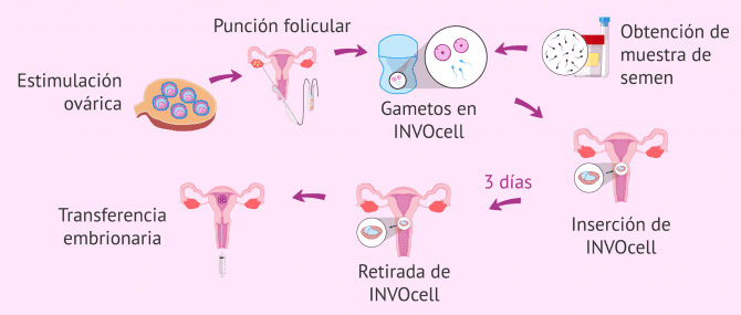 Imagen: Proceso INVO