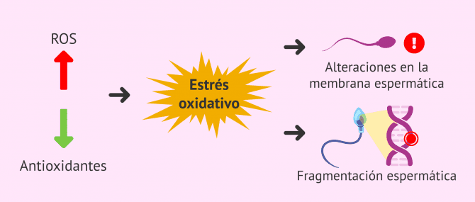 Imagen: Estrés oxidativo y aborto recurrente