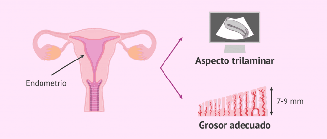 Imagen: Seguimiento del endometrio por ecografía