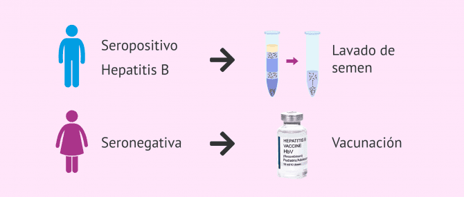 Imagen: Determinación sérica del virus de la hepatitis B