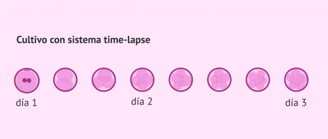 Imagen: Selección embrionaria con time-lapse