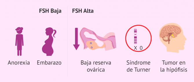 Imagen: Alteraciones de los valores de FSH en la mujer