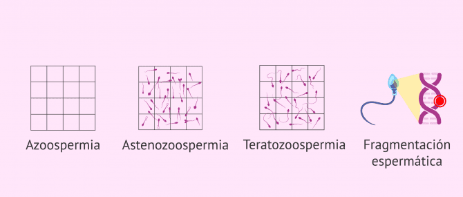 Imagen: Consecuencias de las infecciones seminales en la fertilidad masculina