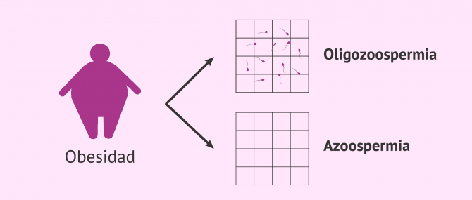 Imagen: Obesidad y calidad seminal