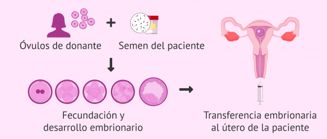 Imagen: Ovodonación e infertilidad femenina