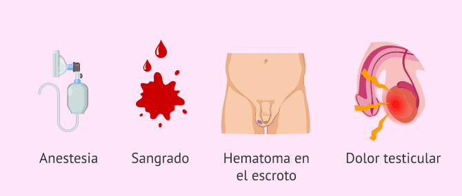 Imagen: ¿Cuáles son los riesgos de la biopsia testicular?