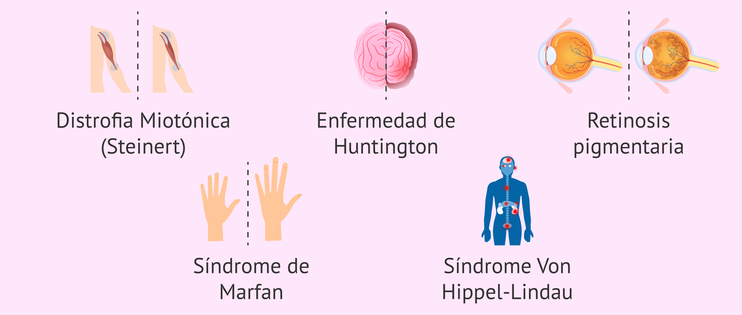 Imagen: Listado de algunas enfermedades de herencia autosómica dominante