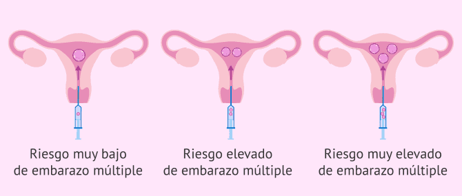 Imagen: Riesgo de embarazo múltiple según el número de embriones