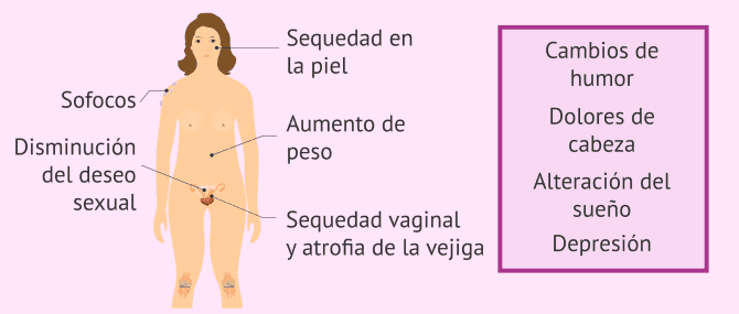 Imagen: Síntomas de la menopausia precoz