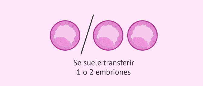 Imagen: Transferencia de 1 o 2 embriones