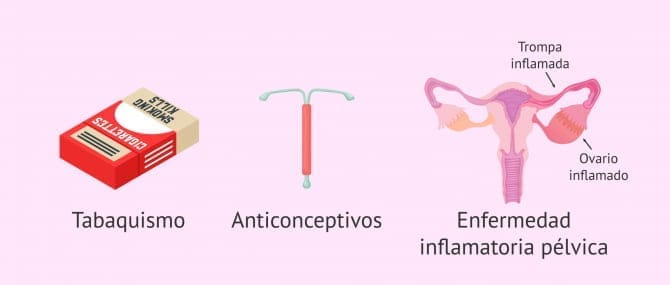 Imagen: Motivos por los que se produce el embarazo ectópico.