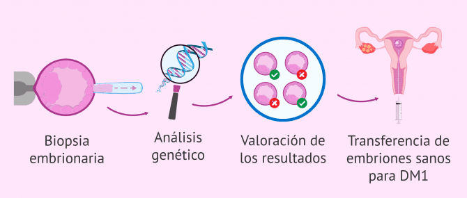 Imagen: Test genético preimplantacional para la DM1