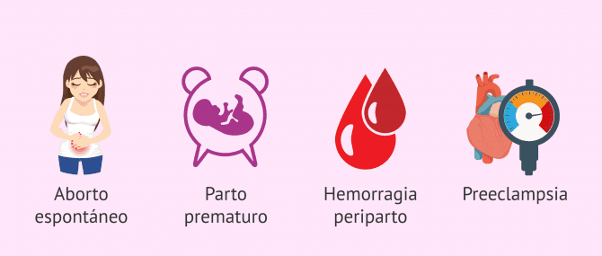 Imagen: Enfermedad de Steinert y embarazo