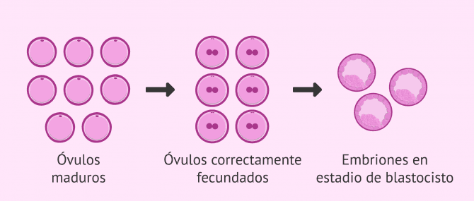 Imagen: Óvulos obtenidos y número de blastocistos