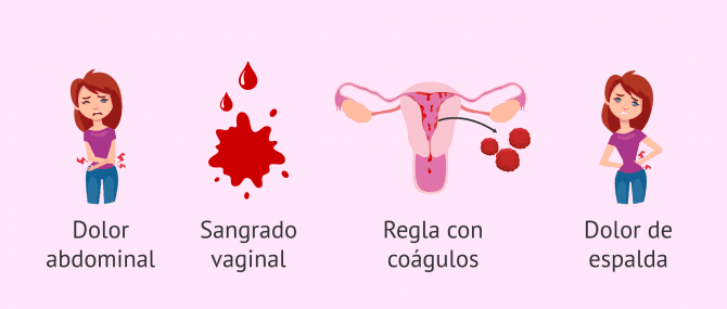 Imagen: Síntomas del embarazo bioquímico