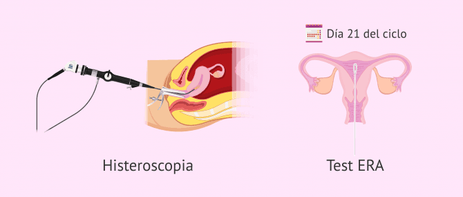 Imagen: Técnicas complementarias para estudiar el endometrio