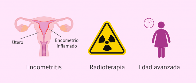 Imagen: causas-del-endometrio-refractario