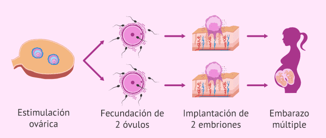 Imagen: Gemelos y reproducción asistida