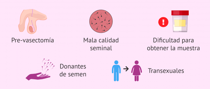 Imagen: ¿Cuándo se recomienda congelar semen?