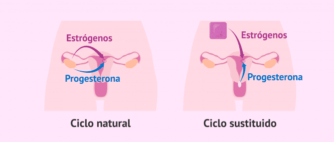 Imagen: Transferencia embrionaria en ciclo natural o sustituido