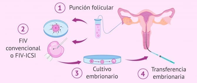 Imagen: Inseminación de los ovocitos en la fecundación in vitro