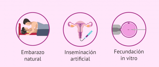 Imagen: Factor tubárico unilateral y posibilidad de embarazo