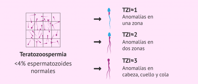 Imagen: Número de alteraciones e índice de teratozoospermia