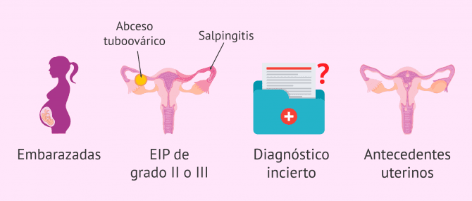 Imagen: ¿Cuándo está indicada la hospitalización por EIP?