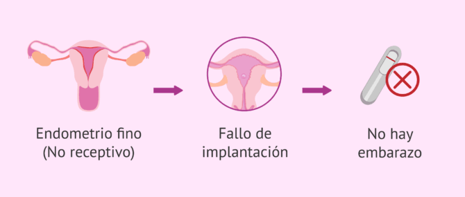 Imagen: ¿Cuándo está indicado el scratching endometrial?